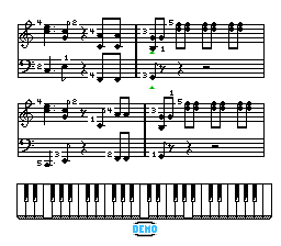 Miracle Piano Teaching System, The — ss (US)