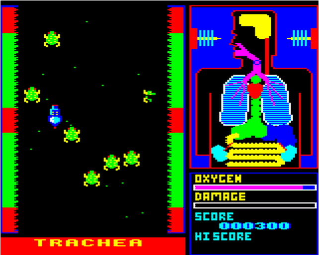Frankenstein 2000 — ss (EU)