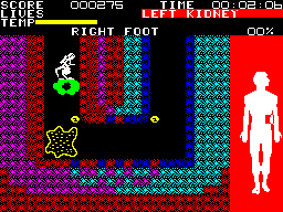 Fantastic Voyage — ss (EU)