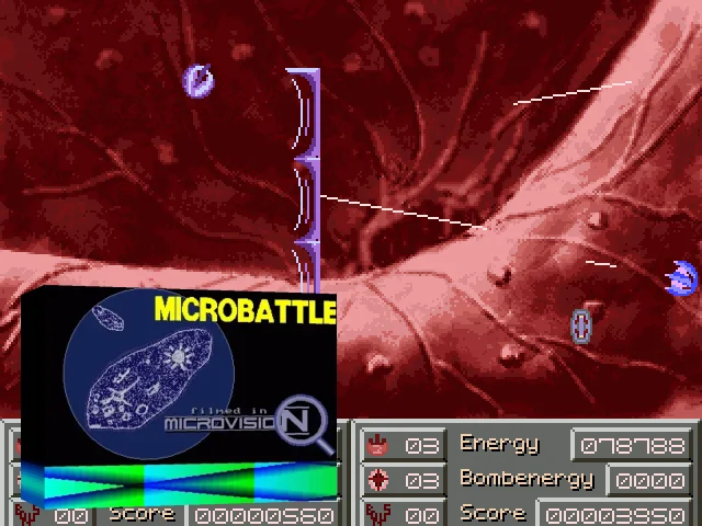 Microbattle — mixrbv2 (WOR)