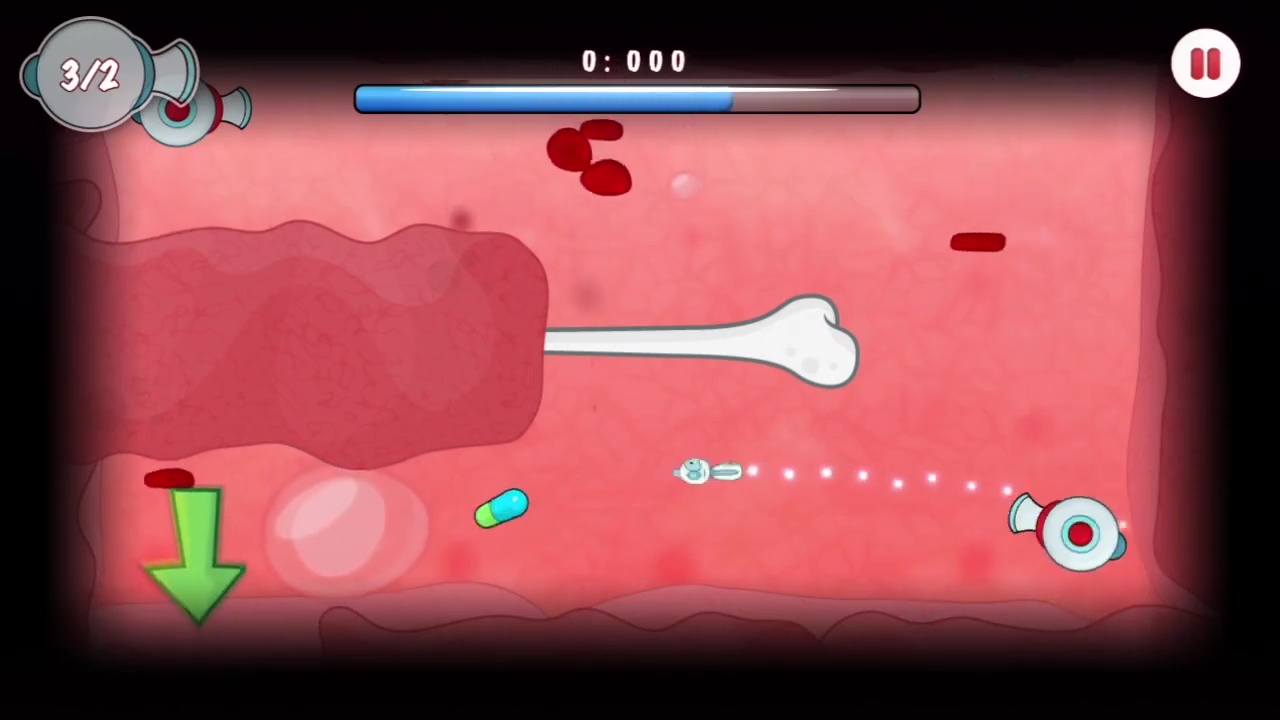 Internal Invasion — ss (US)