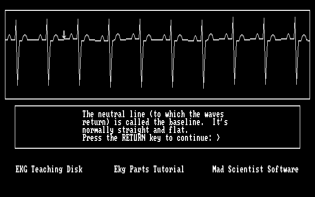 EKG Teaching — ss (WOR)