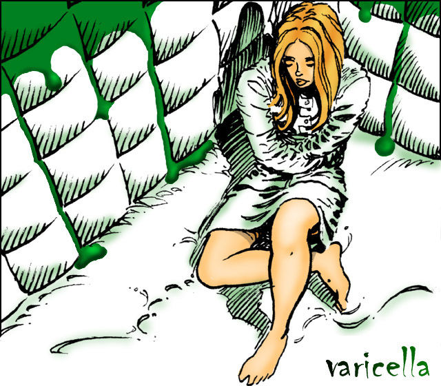 Varicella box art