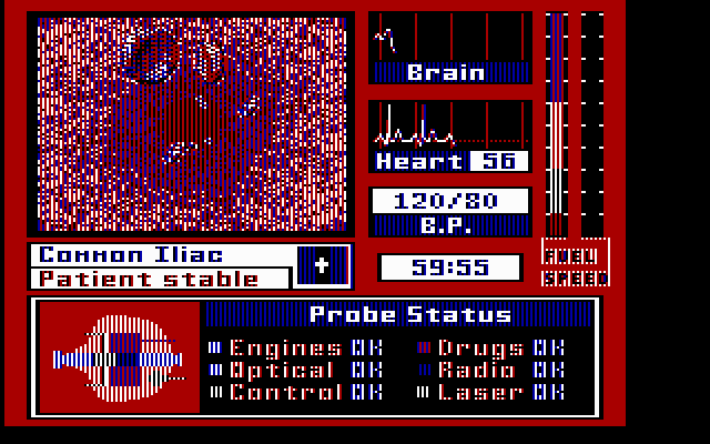 Laser Surgeon The Microscopic Mission — ss (US)